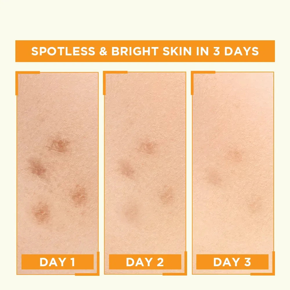 Garnier Skin Naturals Vitamin C Booster Serum 30ml – Bright Complete 30x Vitamin C Formula For Glowing, Spot-Free, And Radiant Skin